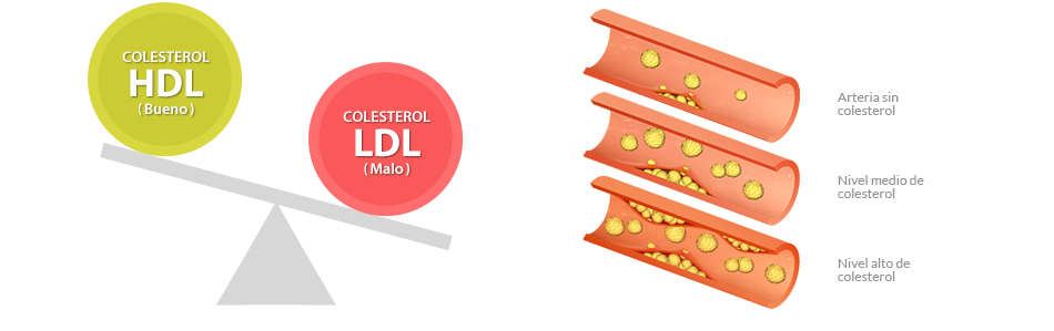 Sintomas del colesterol malo alto
